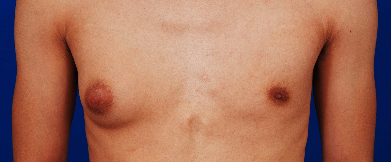 &Gamma;&upsilon;&nu;&alpha;&iota;&kappa;&omicron;&mu;&alpha;&sigma;&tau;ί&alpha; &ndash; &Alpha;&nu;&tau;&iota;&mu;&epsilon;&tau;ώ&pi;&iota;&sigma;&eta;