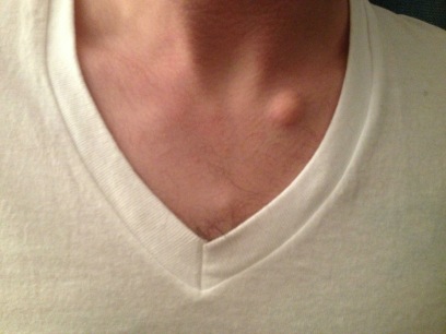 &Lambda;&iota;&pi;ώ&mu;&alpha;&tau;&alpha; &ndash; &Alpha;&nu;&tau;&iota;&mu;&epsilon;&tau;ώ&pi;&iota;&sigma;&eta;