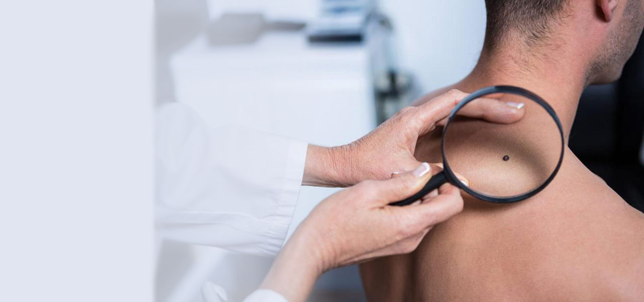 Ό&gamma;&kappa;&omicron;&iota; &delta;έ&rho;&mu;&alpha;&tau;&omicron;&sigmaf; - &Alpha;&nu;&tau;&iota;&mu;&epsilon;&tau;ώ&pi;&iota;&sigma;&eta;