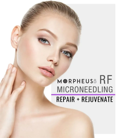 Morpheus8 για αναίμακτο lifting! Morpheus8 για αναίμακτο lifting!